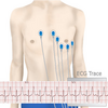 Basic ECG Interpretation