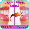 Braces Photo Editor 2017