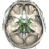 CT Scan Cross Sectional Anatomy for Imaging Pros