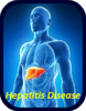 Hepatitis Disease