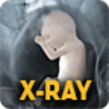 X-Ray Body Scanner