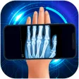 Xray Scanner : Body Scanner