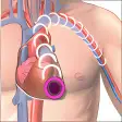 MB Heart Attack Risk Calculator